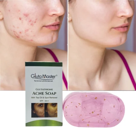 Glutathione Acne Pimples Soap